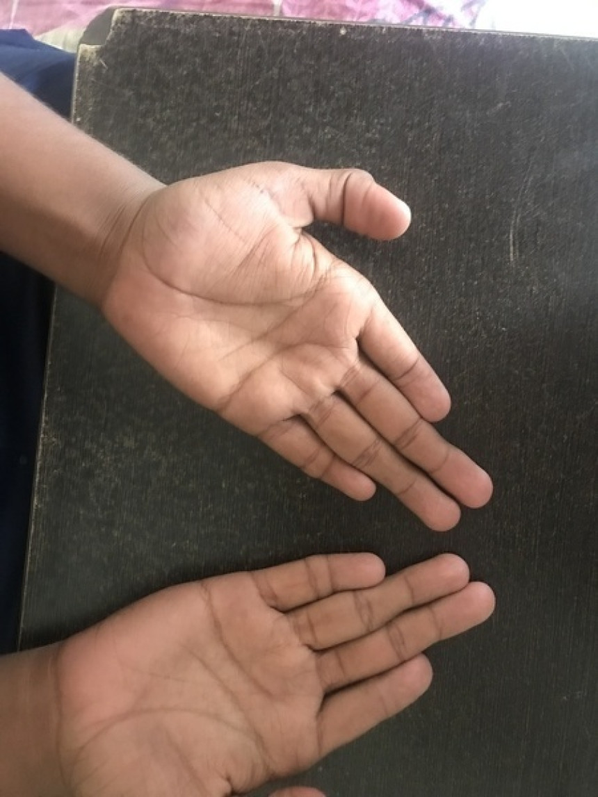 Shortest Pair of Index Fingers